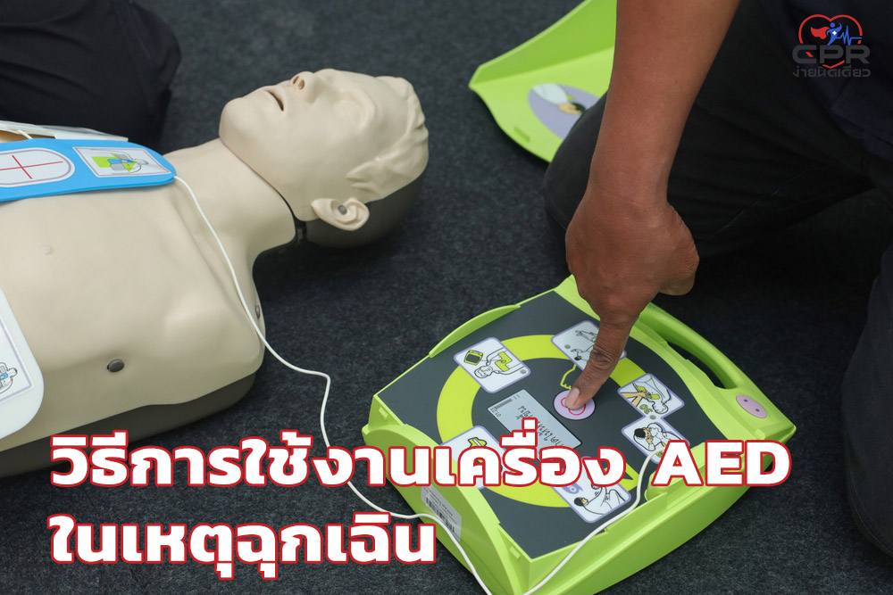 วิธีการใช้งานเครื่อง AED ในเหตุฉุกเฉิน